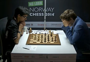 Anish Giri somehow contrived to lose to Sergey Karjakin. Photo © 